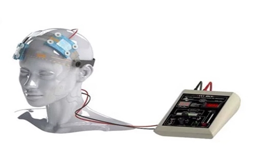 Iran develops breakthrough non-invasive deep brain stimulation device for addiction treatment 1 IMG 1113
