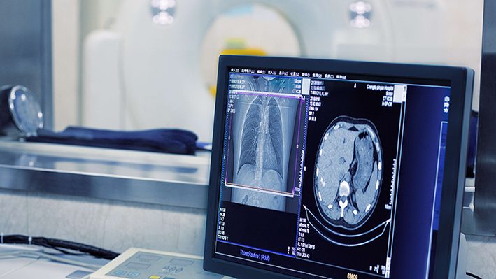 Iranian AI platform revolutionizes medical imaging analysis 1 Iranian AI platform revolutionizes medical imaging analysis
