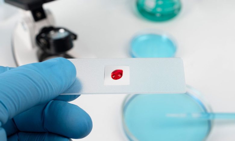 Iranian researchers develop portable device for early detection of blood cancers 1 IMG 7459